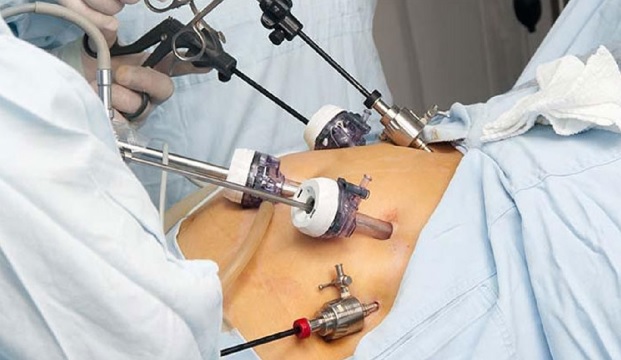 A Guide to Hysteroscopy Procedure in Mumbai: What You Need to Know