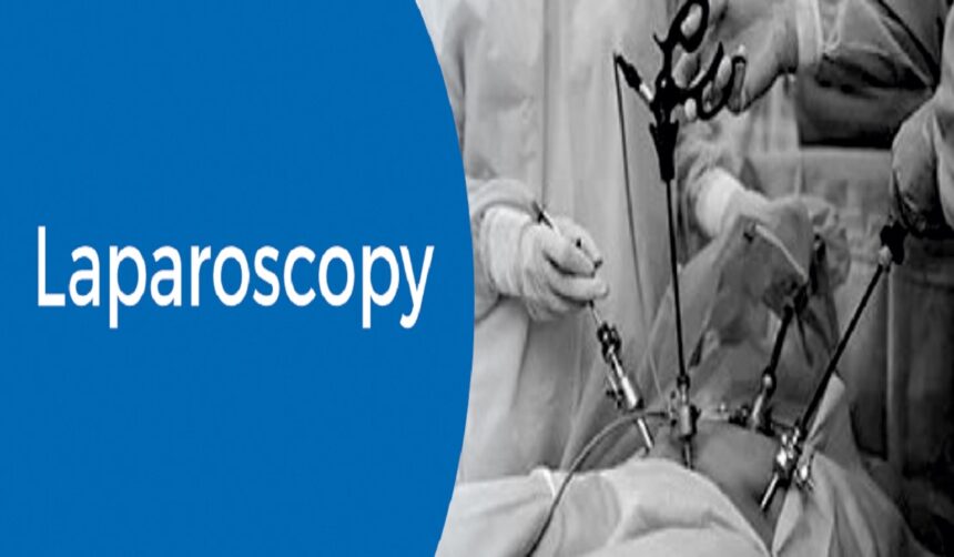 How to Prepare for Laparoscopy for Fertility in Bangalore: Tips and Advice