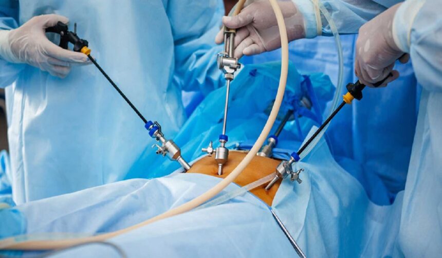 Understanding laparoscopy surgery: What to expect in Mumbai
