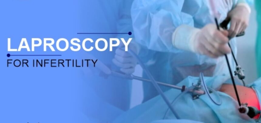 Laparoscopic Surgery: The Key to Conceiving in Ghaziabad