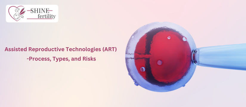 Assisted Reproductive Technologies (ART) – ART Process, Types, and Risks of ART