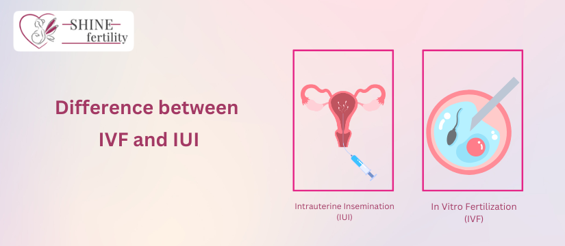 Difference between Intrauterine Insemination (IUI) and In Vitro Fertilization (IVF)