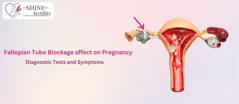 Fallopian Tube Blockage affect on Pregnancy – Diagnostic Tests and Symptoms