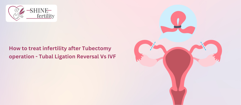 How to treat infertility after Tubectomy operation – Tubal Ligation Reversal Vs IVF