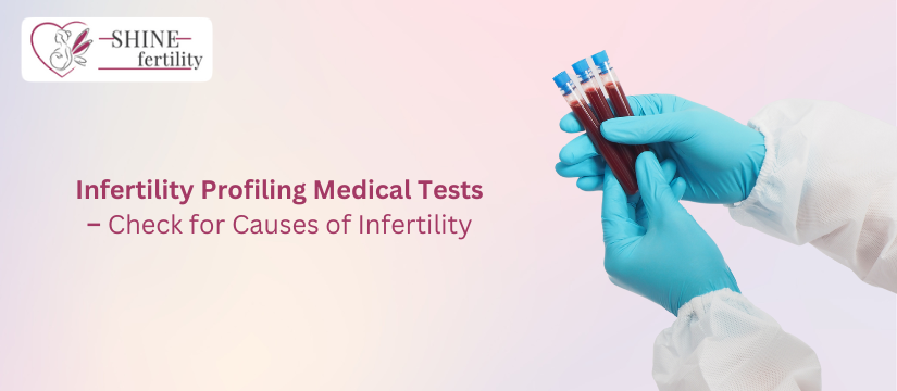 Infertility Profiling Medical Tests – Check for Causes of Infertility