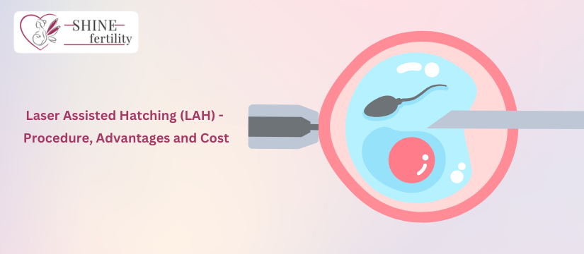 Laser Assisted Hatching (LAH) – Procedure, Advantages and Cost of LAH