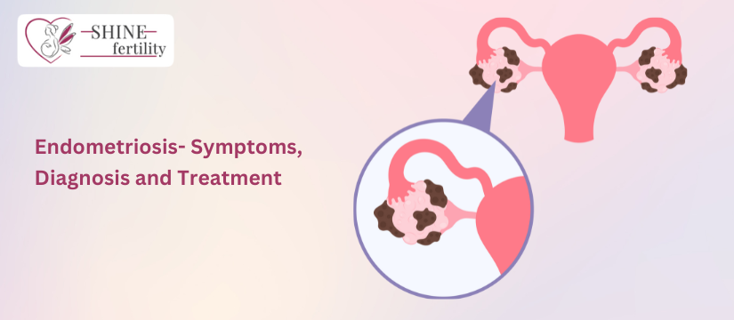 What is Endometriosis? What are Endometriosis Symptoms, Diagnosis, and Treatment?